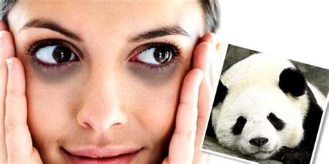 Penyebab Mata Panda Pada Remaja